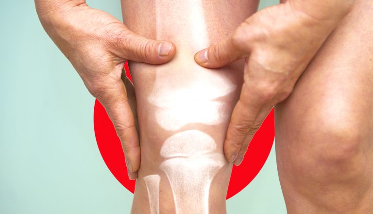 Erase Your Joint Pain For Good